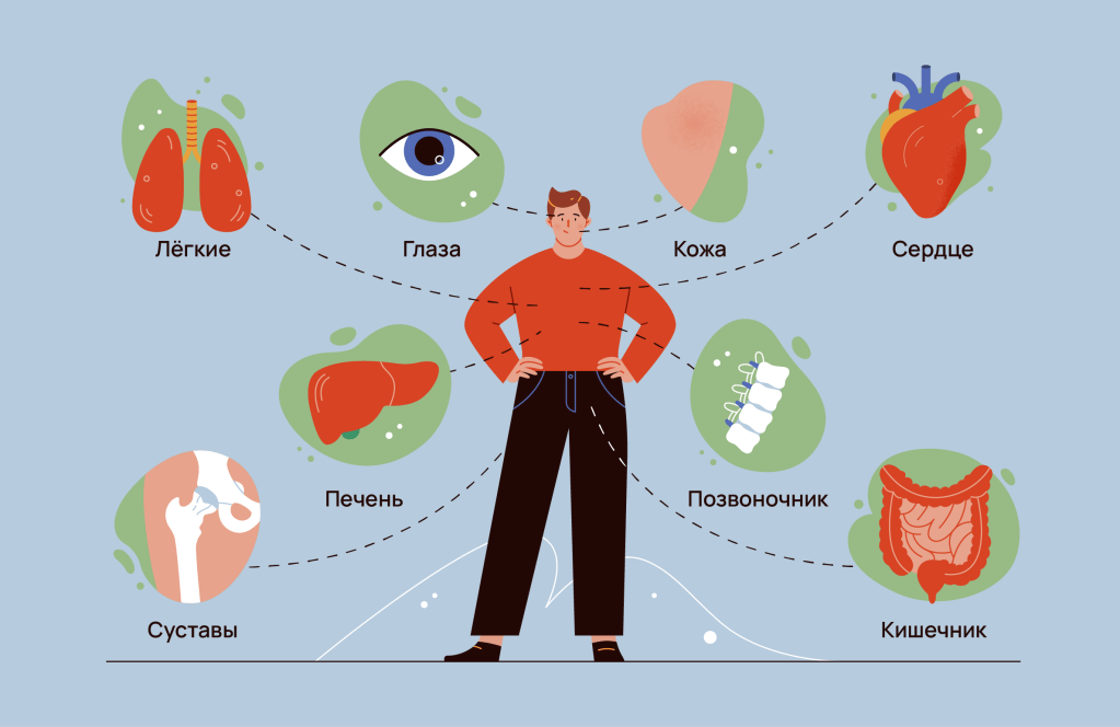Коморбидные симптомы: когда одно цепляется за&nbsp;другое